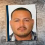 SSPC va contra el «Botox» pirata: Inician operativos en clínicas estéticas