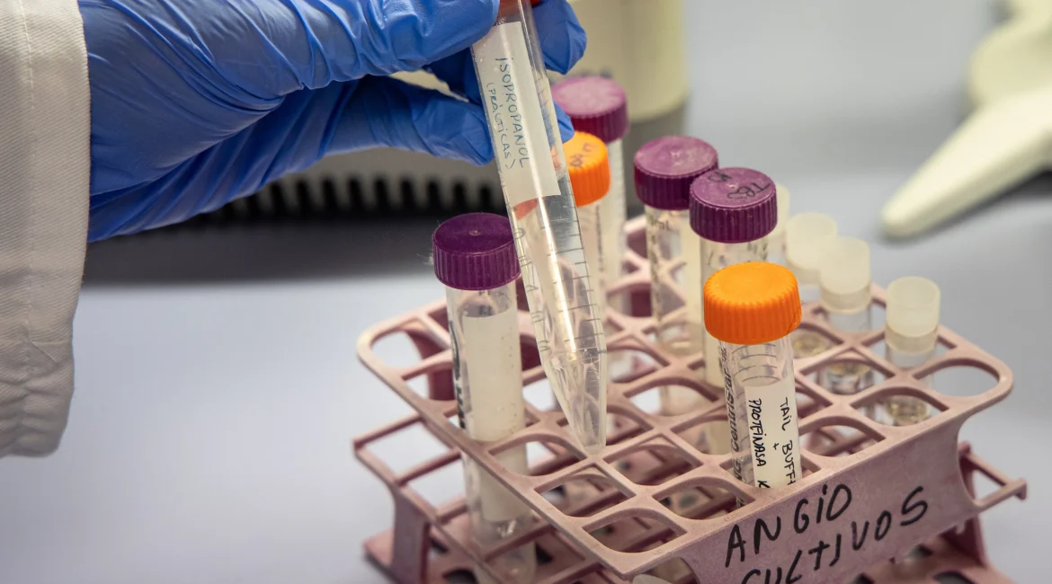 La investigación del CIBIR estudia una terapia génica contra el Alzheimer