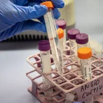 España impulsa una nueva estrategia contra el Alzheimer