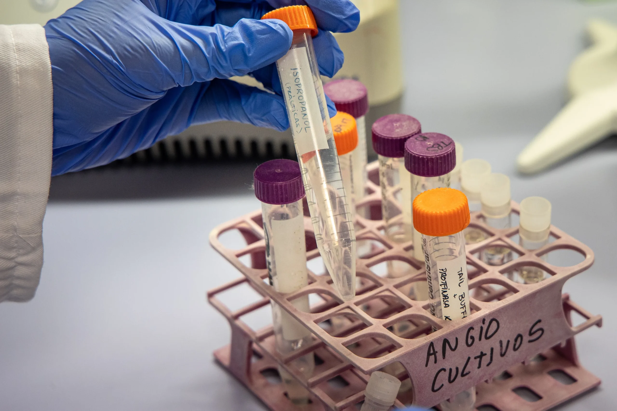 España impulsa una nueva estrategia contra el Alzheimer